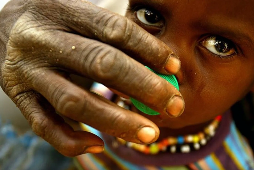 UN: Sudan crisis leaves millions to struggle with hunger and malnutrition