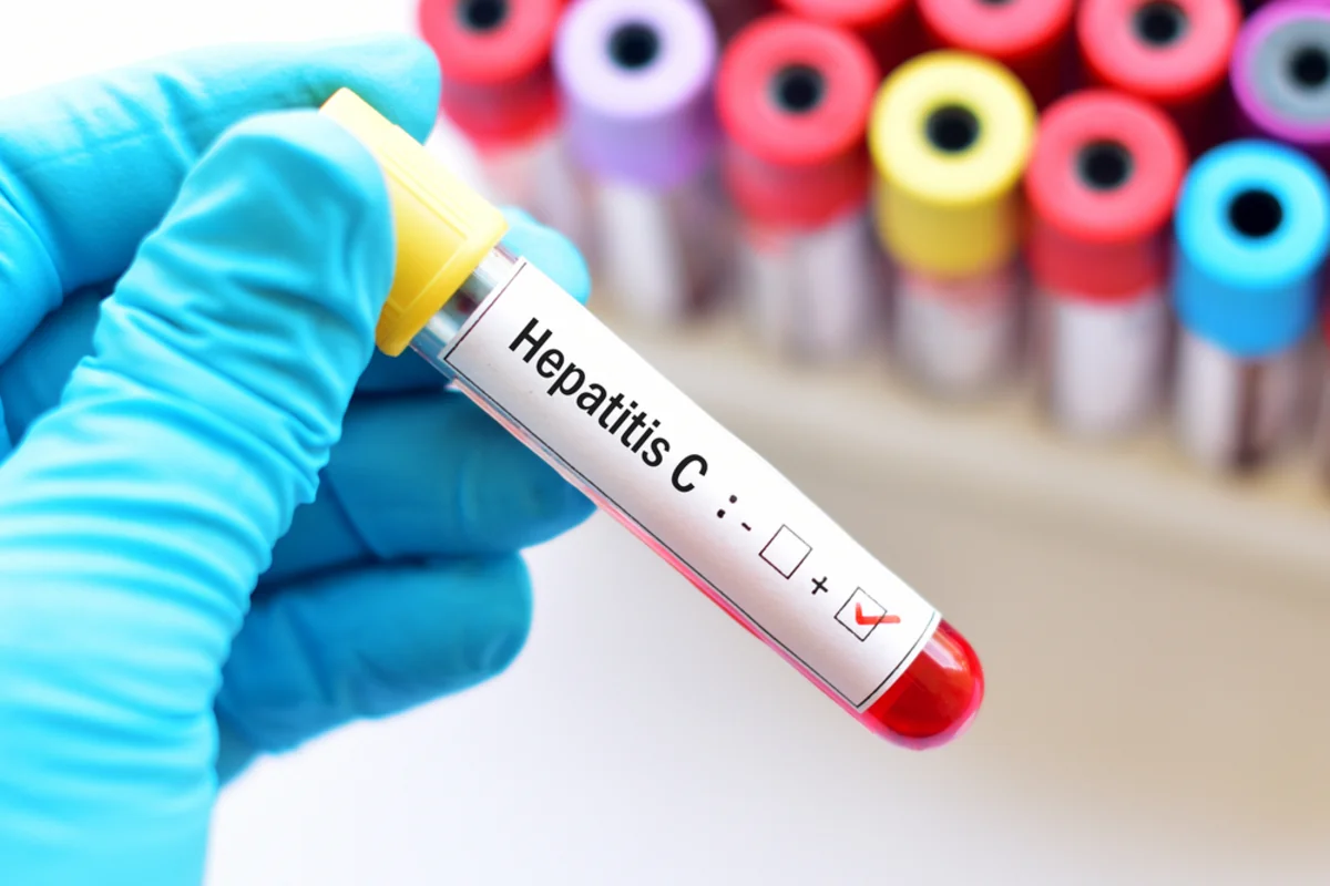 Azərbaycanda qeydiyyata alınan hepatit xəstələrinin sayı açıqlanıb