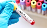 Azərbaycanda qeydiyyata alınan hepatit xəstələrinin sayı açıqlanıb