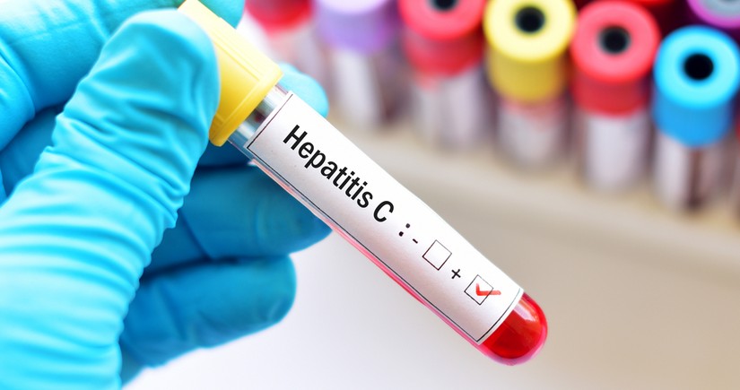 Azərbaycanda qeydiyyata alınan hepatit xəstələrinin sayı açıqlanıb