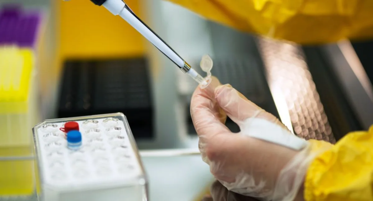 Armenia confirms 383 new COVID cases 