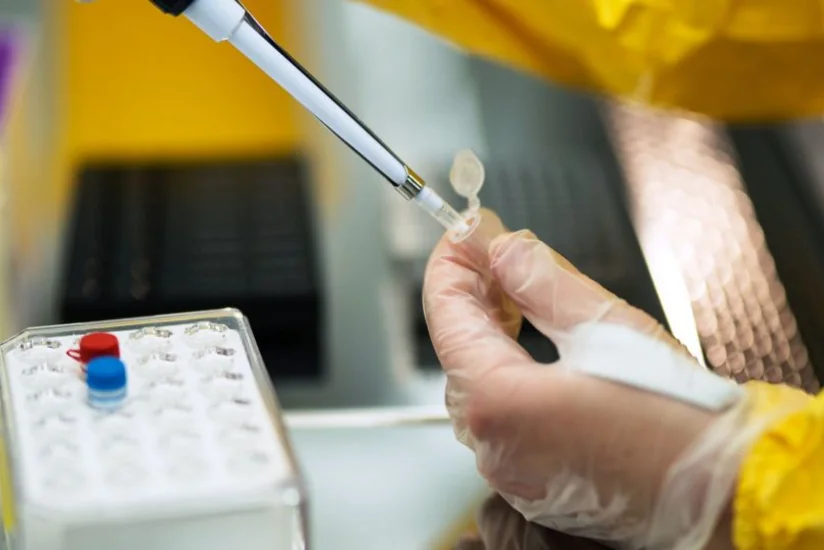 В Армении за сутки число случаев COVID-19 составило 383