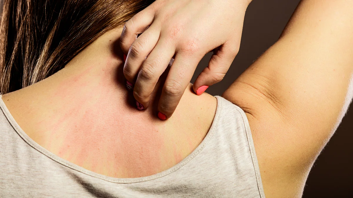 Britaniyada epidemiya yayılıb