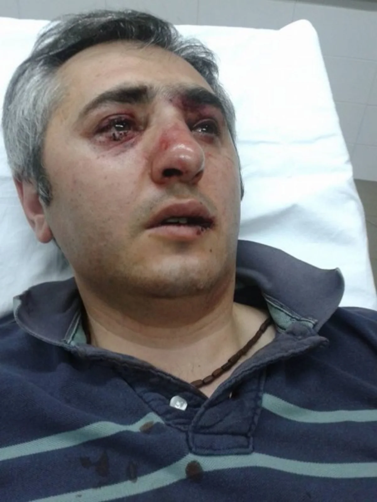 ​Yerevanda keçirilən mitinqdə erməni dosent polislər tərəfindən döyülüb - FOTO