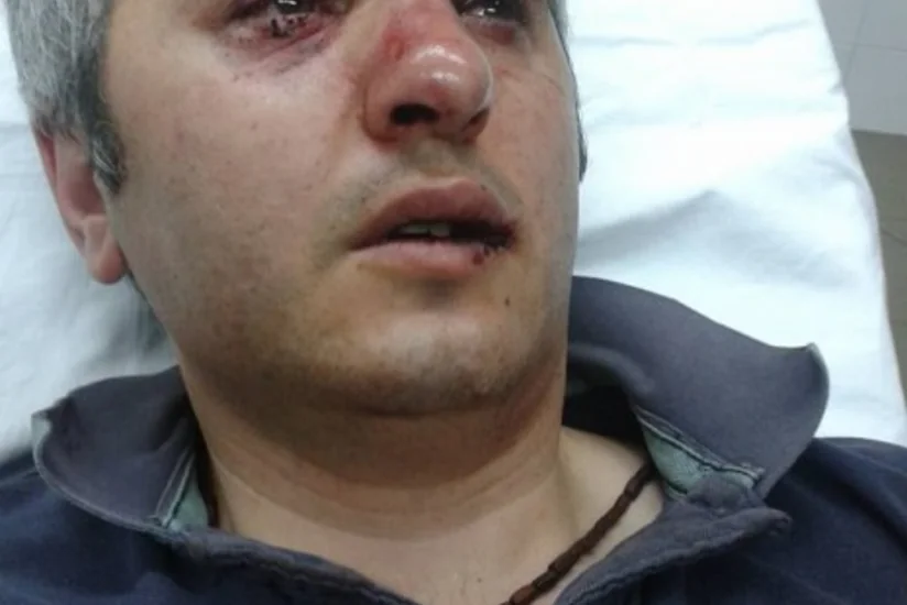 ​Yerevanda keçirilən mitinqdə erməni dosent polislər tərəfindən döyülüb - FOTO
