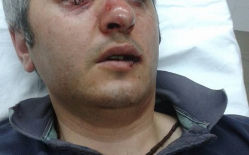 ​Yerevanda keçirilən mitinqdə erməni dosent polislər tərəfindən döyülüb - FOTO