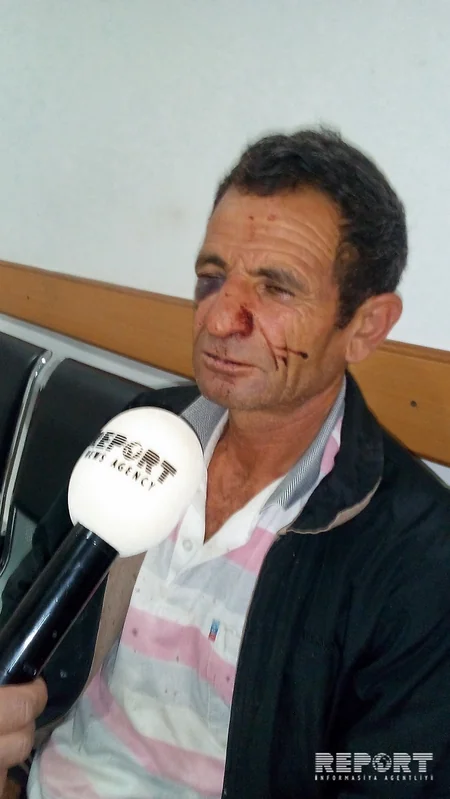 Şamaxıda kütləvi dava: Ər-arvad döyülüb - FOTO