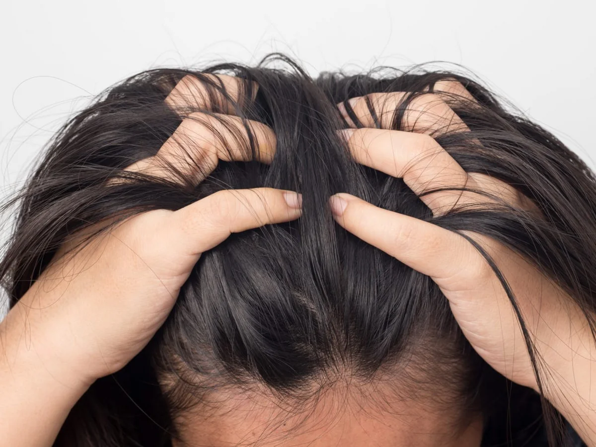 Kəpək təhlükəli xəstəliyin simptomu ola bilər