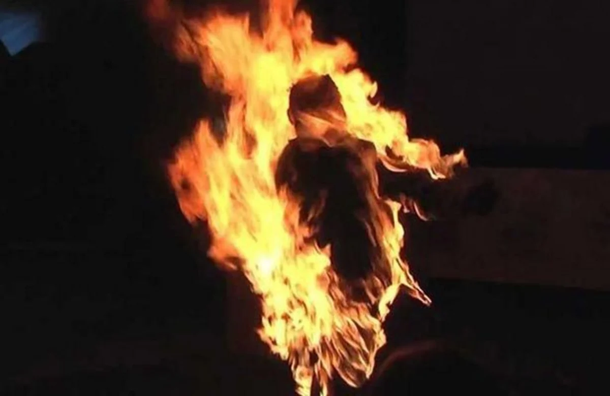 Samuxda özünü yandıran keçmiş universitet müəllimi xəstəxanada ölüb - YENİLƏNİB