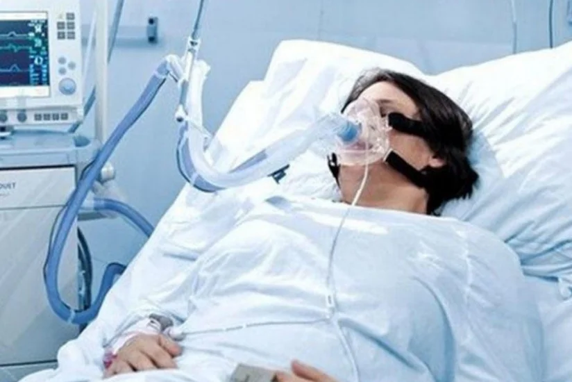 ABŞ altı ölkəyə süni ağciyər ventilyasiya aparatı verə bilər