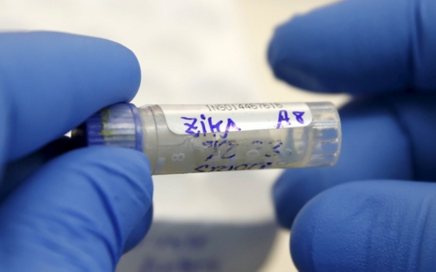Rusiyada Zika virusuna yoluxma ilə bağlı ilk hal qeydə alınıb