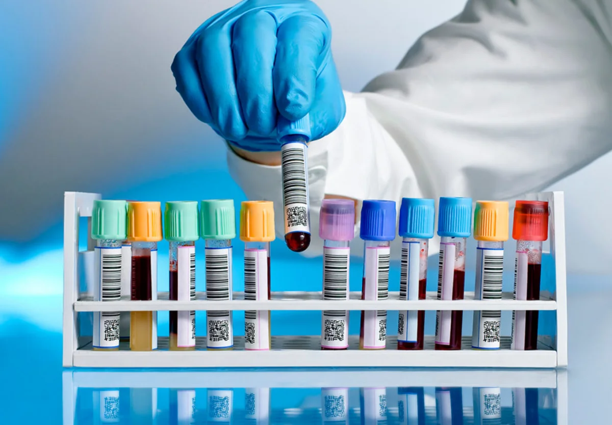 Azerbaijan records another 19 COVID cases today 