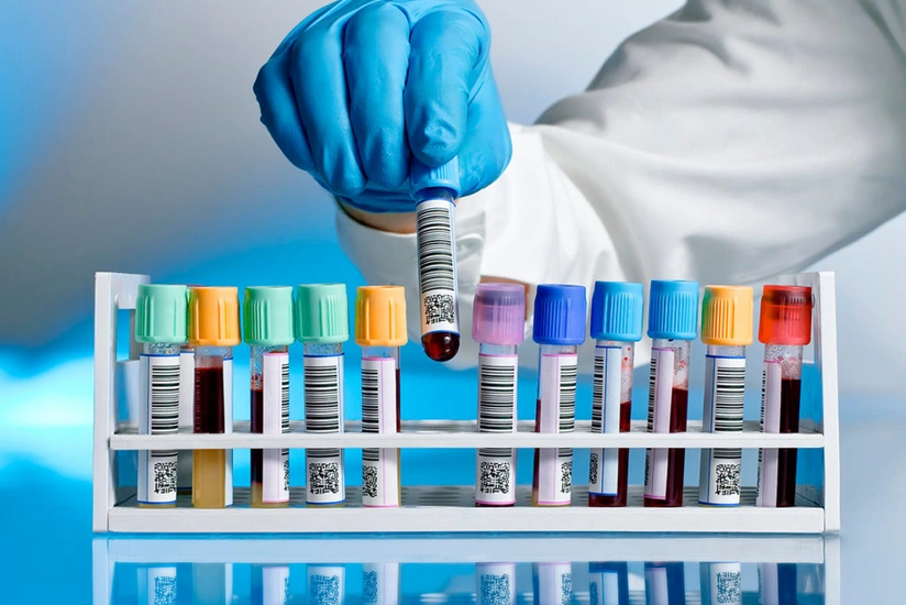 В Азербайджане коронавирусом заразились еще 19 человек