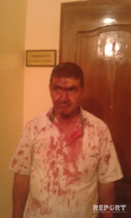 İmişlidə heyvan bazarında kütləvi dava düşüb, ata və 3 oğlu döyülüb - FOTO