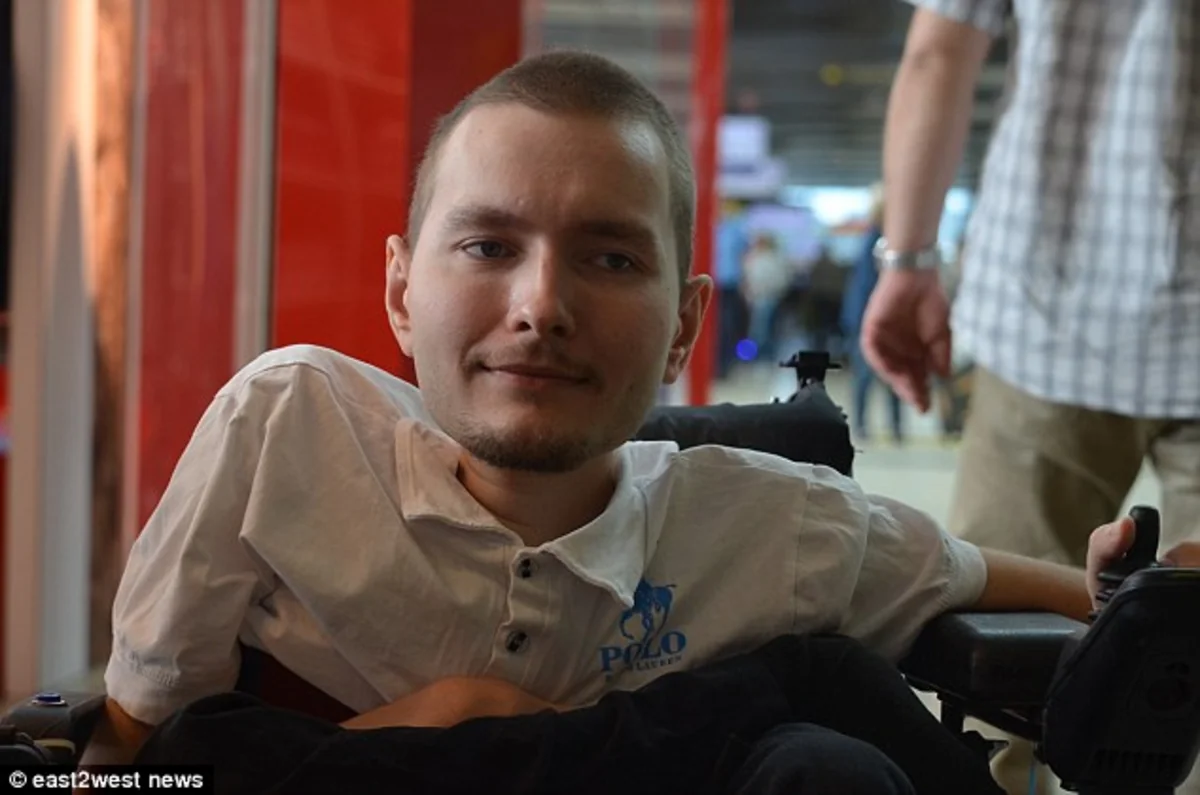 36-hour head transplant of 11 million USD to be carried out in China in 2017