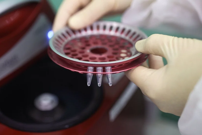 В Испании 132 человека заразились оспой обезьян