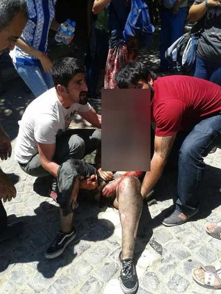 Türkiyənin Şanlıurfa vilayətində terror aktı: ölənlərin sayı 31-ə çatıb - YENİLƏNİB 4 - VİDEO