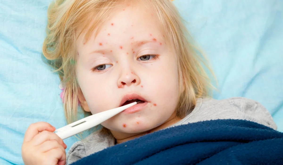 Mərkəz rəhbəri: “Gürcüstan qızılca epidemiyası təhlükəsi ilə üz-üzədir”