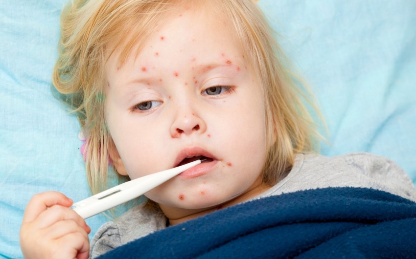 Mərkəz rəhbəri: “Gürcüstan qızılca epidemiyası təhlükəsi ilə üz-üzədir”