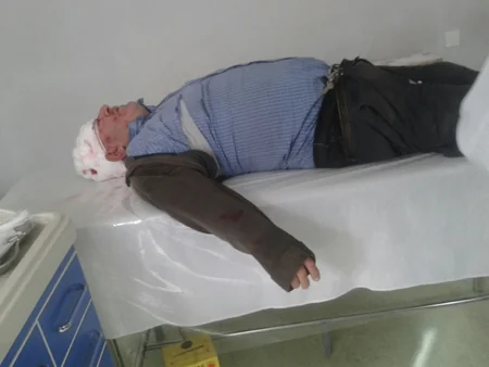 ​Azərbaycanda sürücü ahıl kişini maşınla vuraraq qaçıb - FOTO - YENİLƏNİB