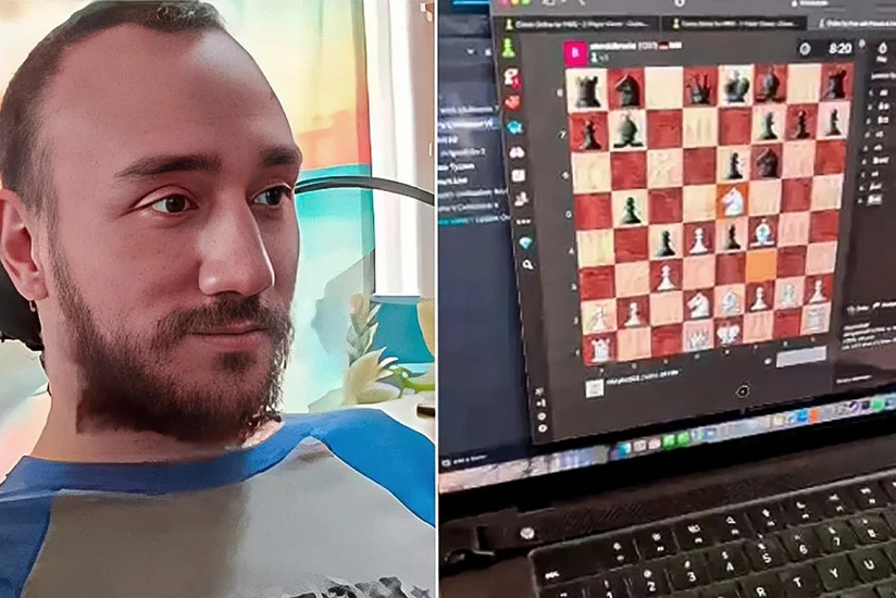 Musk: First Neuralink patient posts on X using brain chip device