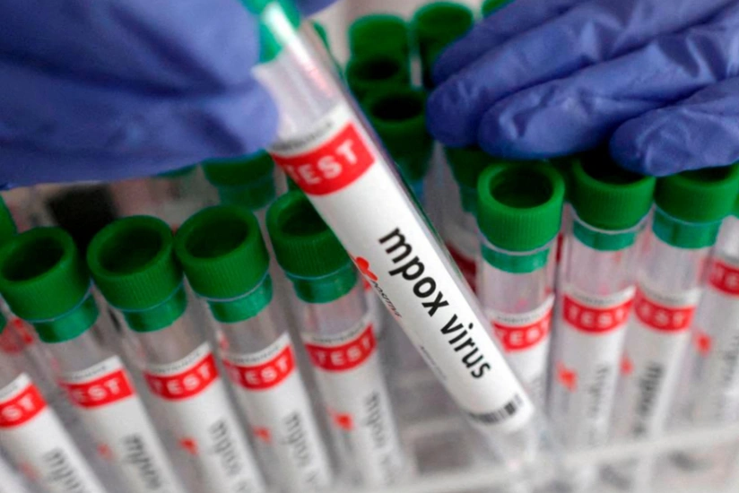 Son bir ayda Afrikada meymunçiçəyi virusuna 2 mindən çox şəxs yoluxub