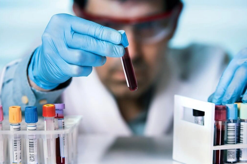 Türkiyədə pandemiya qurbanlarının sayı 2 600 nəfərə çatdı - FOTO