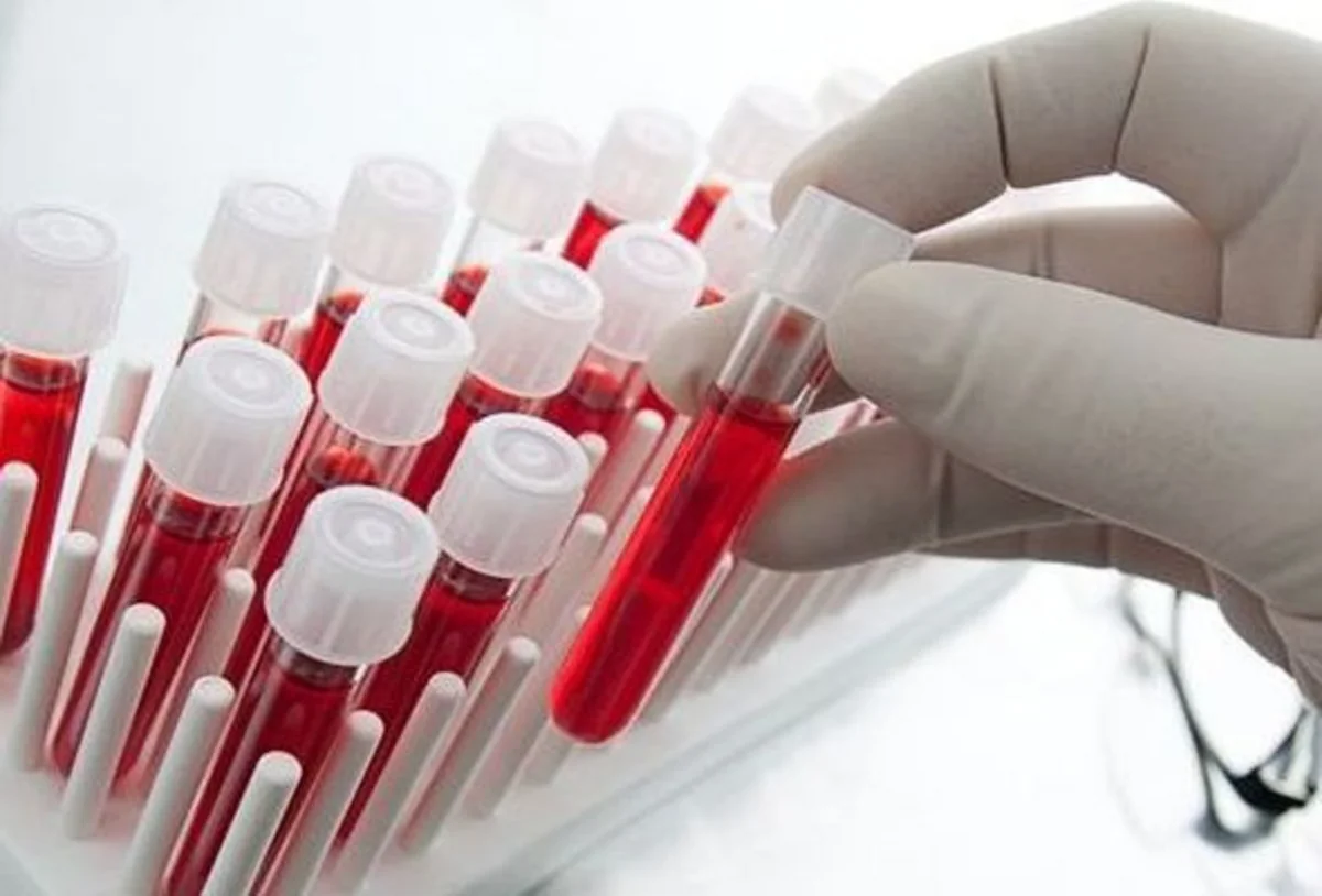 Blood samples taken from persons coming to Azerbaijan and suspected of 'swine flu'