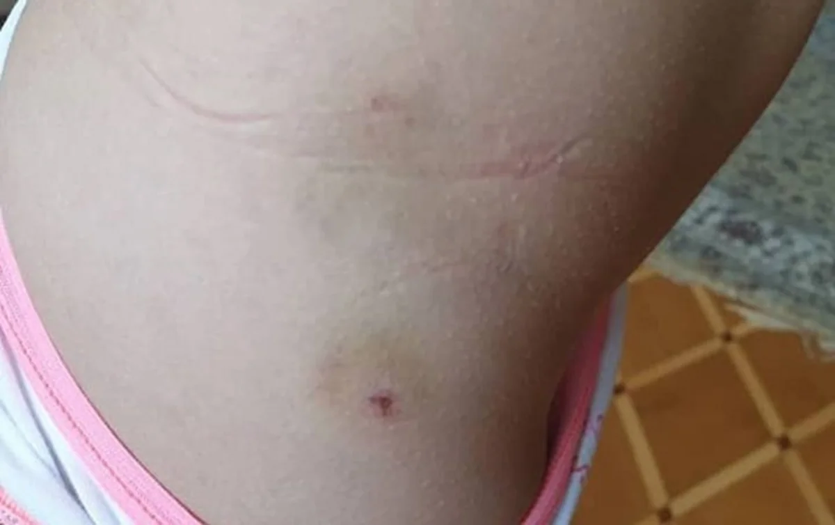 Novxanıdakı restoranlardan birində azyaşlı uşağı it dişləyib - FOTO