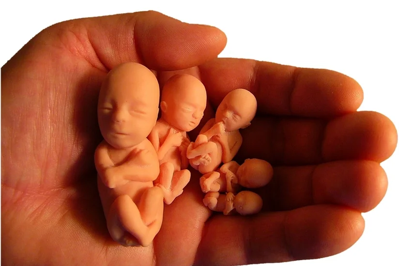 Həkimin xəstəxanadan kənarda abort etməsinə görə cərimə miqdarı 5 dəfə artırılır