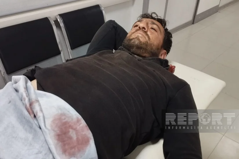 Kürdəmir sakini özünə tüfənglə xəsarət yetirib