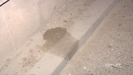 Bakıda orta yaşlı kişi naməlum şəraitdə bıçaqlanıb  - FOTO