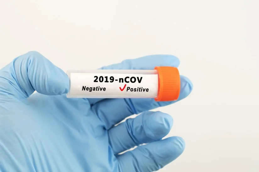 Azerbaijan reports 1,663 new coronavirus cases: Task Force