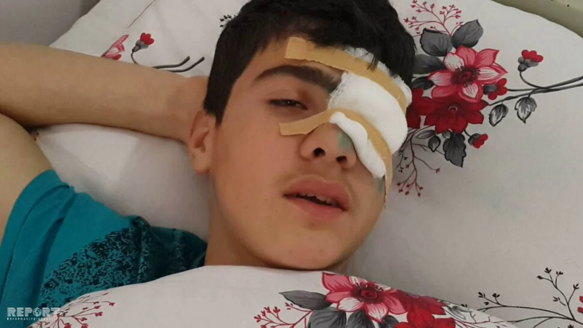 Abşeronda məktəbli açılan atəş nəticəsində gözündən yaralanıb - FOTO - ƏLAVƏ OLUNUB