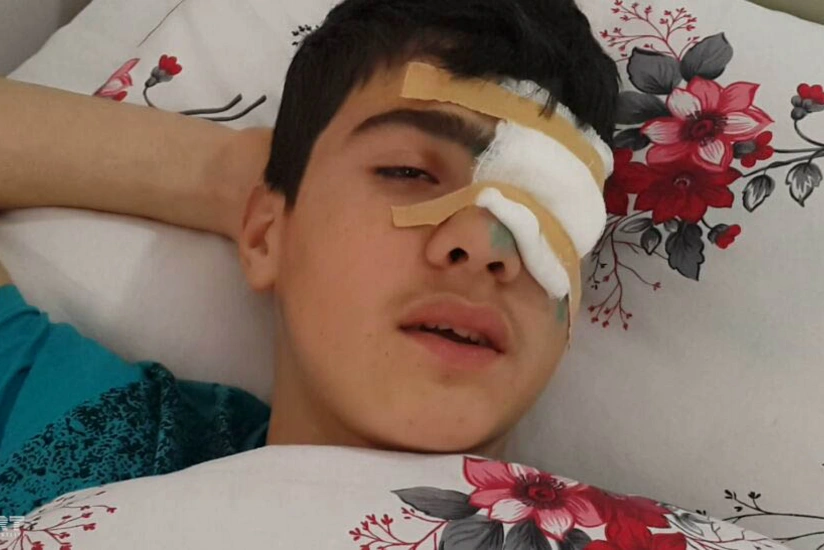 Abşeronda məktəbli açılan atəş nəticəsində gözündən yaralanıb - FOTO - ƏLAVƏ OLUNUB