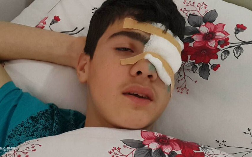 Abşeronda məktəbli açılan atəş nəticəsində gözündən yaralanıb - FOTO - ƏLAVƏ OLUNUB
