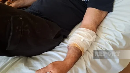 Ukraynanın 30 şəhər və kəndinə hava hücumu olub, yaralılar arasında azərbaycanlı da var - YENİLƏNİB