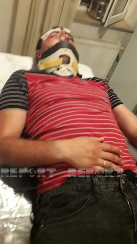 Kürdəmirdə ağır yol qəzası olub, xəsarət alanlar var