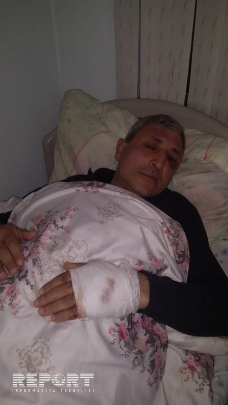 Cəlilabad sakini borca görə döyülüb - FOTO