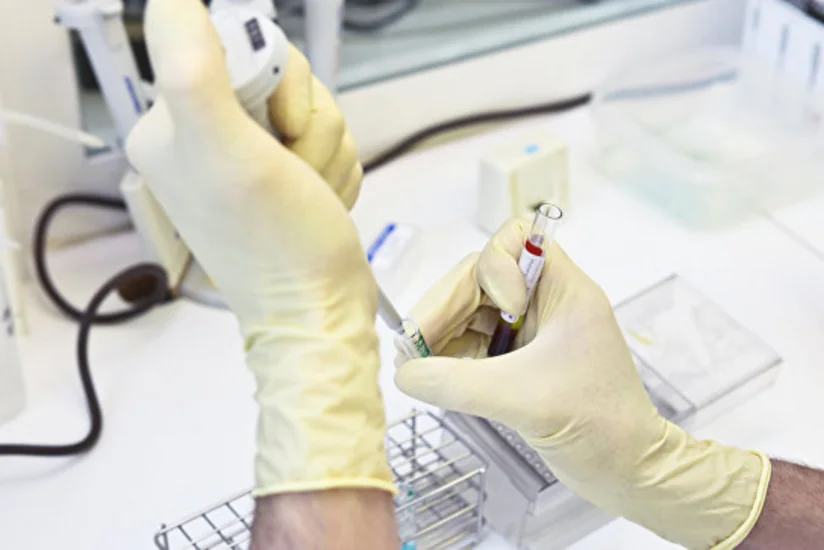 Вспышка гепатита А зафиксирована в Европе