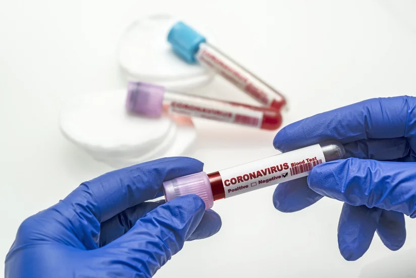 Ədliyyə işçilərindən və məhkumlardan 13 minədək test nümunələri götürülüb