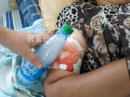 Ermənilərin yaraladığı bacılardan birinin vəziyyəti ağırdır - FOTO