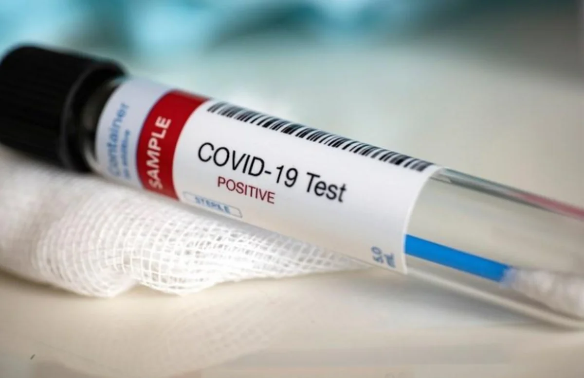 В Нагорном Карабахе растет число заразившихся COVID-19