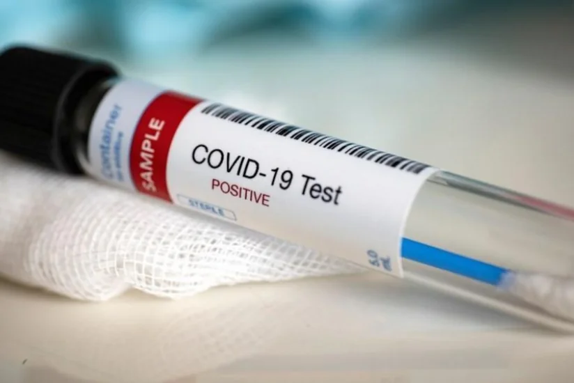 В Нагорном Карабахе растет число заразившихся COVID-19