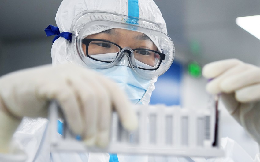 CIA now favors lab leak theory to explain Covid’s origins