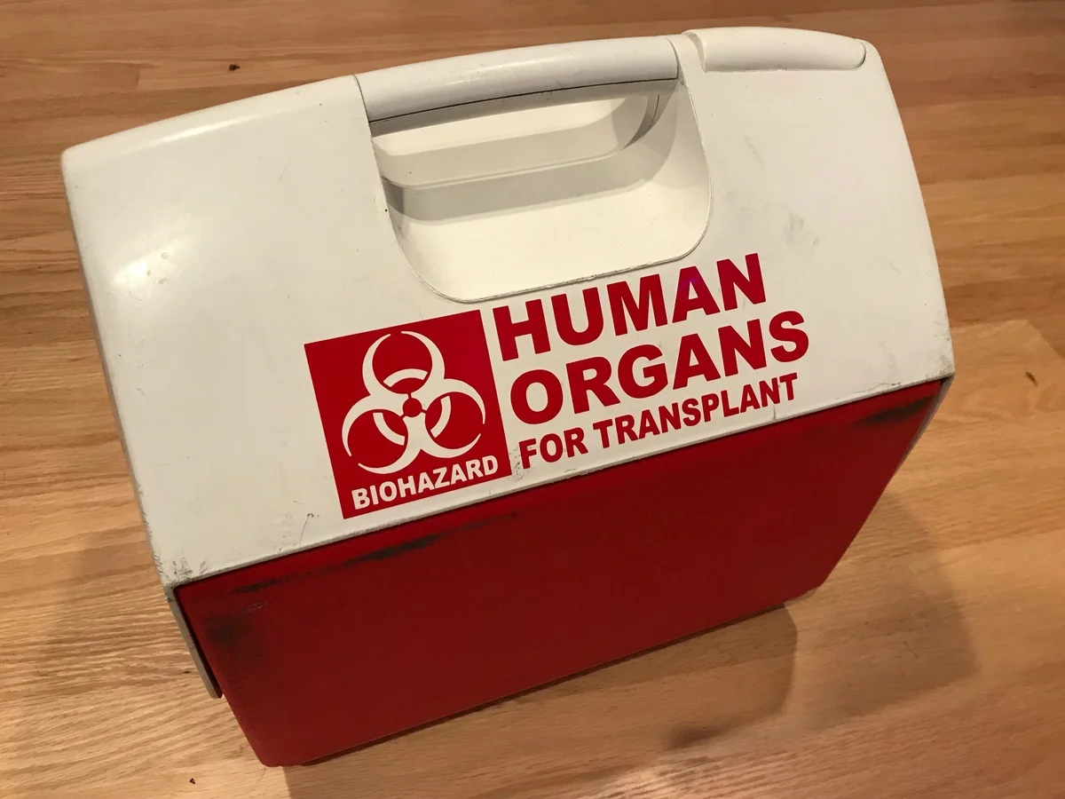 Meyitdən transplantasiya məqsədilə götürüləcək orqan və hüceyrələrin siyahısı müəyyənləşdi