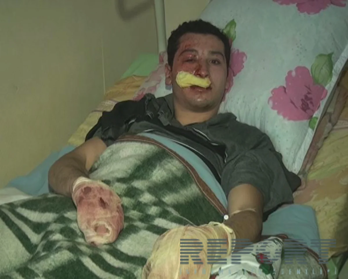 Həkim: Balakəndə partlayış zamanı yaralananların vəziyyəti nisbi kafidir - FOTO - VİDEO