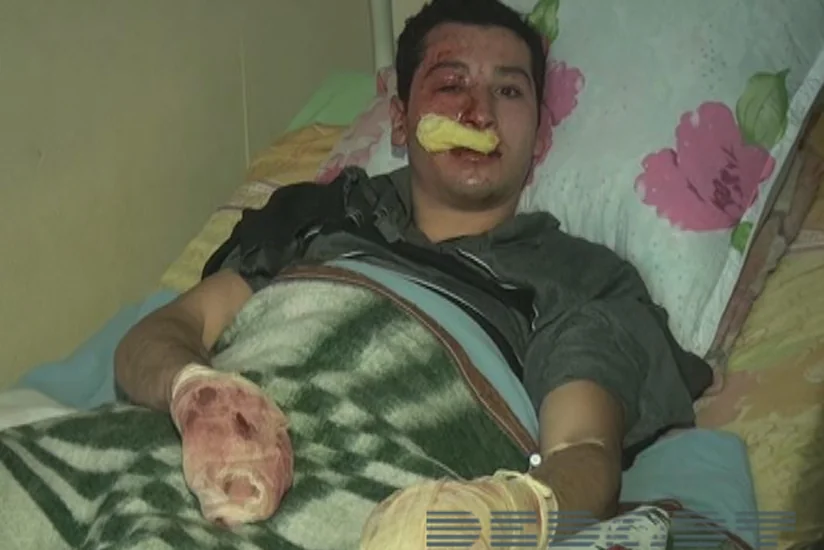 Həkim: Balakəndə partlayış zamanı yaralananların vəziyyəti nisbi kafidir - FOTO - VİDEO