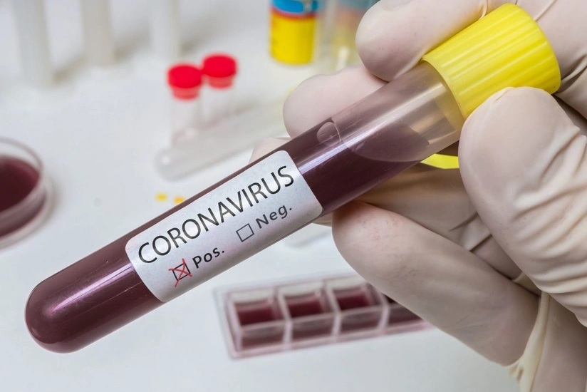 Azerbaijan announces weekly COVID statistics