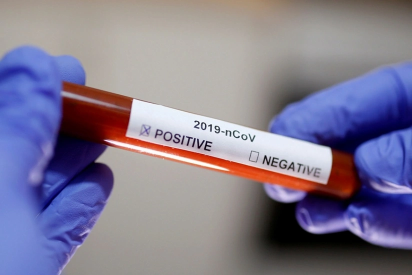 Azerbaijan confirms 9 new COVID-19 cases